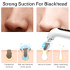 Deep Blackhead Removal Vacuum in USA | Only E-Shop