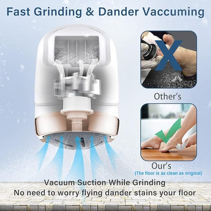 Electric Foot Callus Remover tool in USA | Only E-Shop
